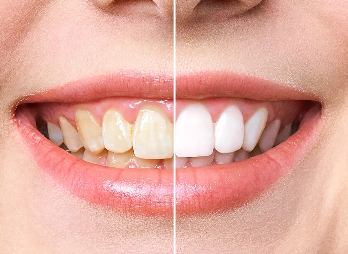 Cosmetic & Restorative Dentistry